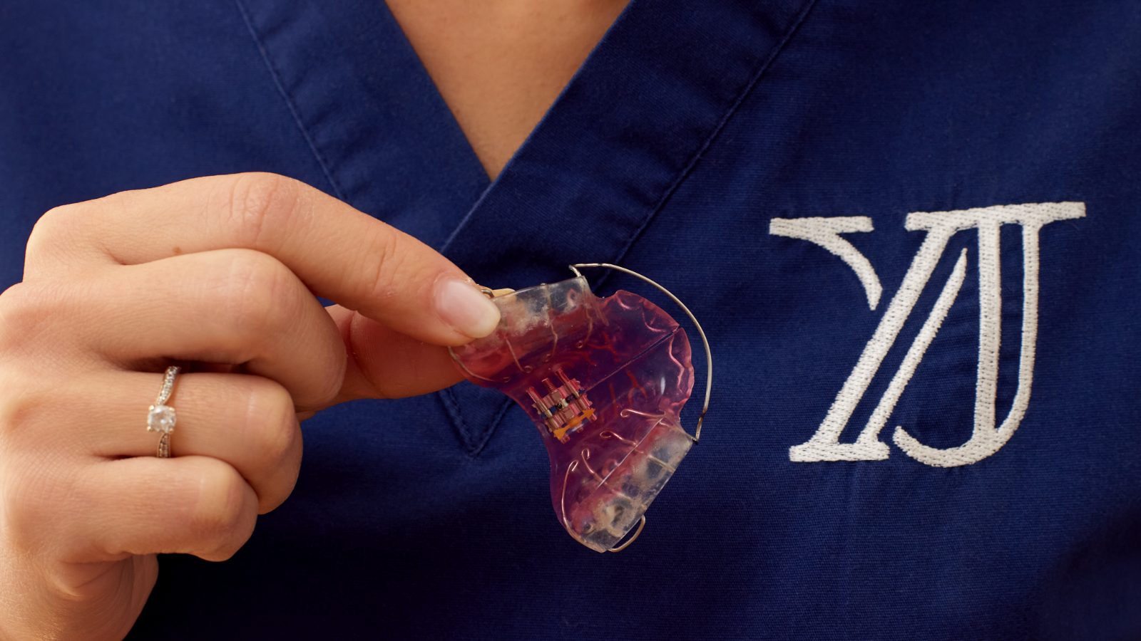 Appareil d'interception, orthodontie de l'enfant
