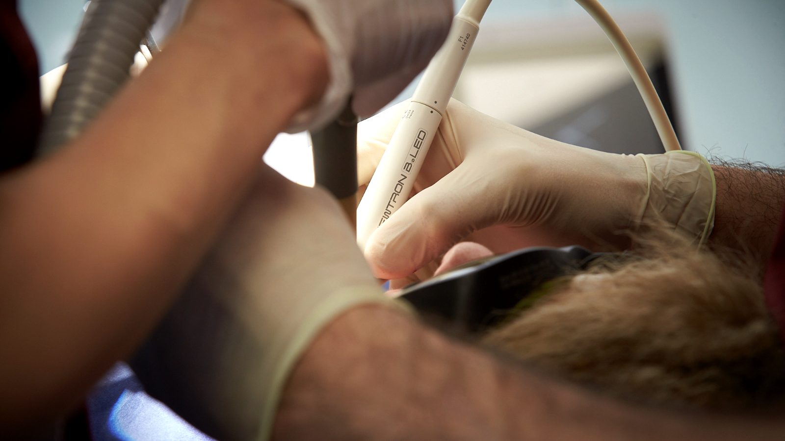 Détartrage aux ultrasons au fauteuil